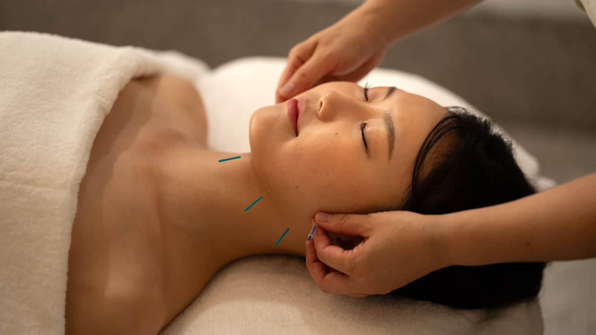 Hyatt Regency Kyoto Spa Riraku Beauty Acupuncture Treatment